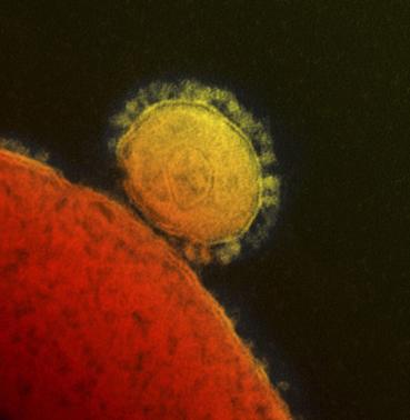 Egypt probing suspected MERS coronavirus death