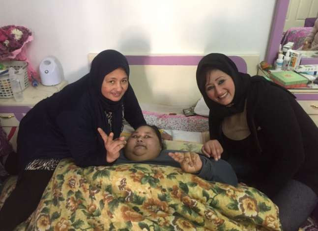 مستشفى هندي ينشيء وحدة خاصة لعلاج مصرية تعاني من بدانة مفرطة