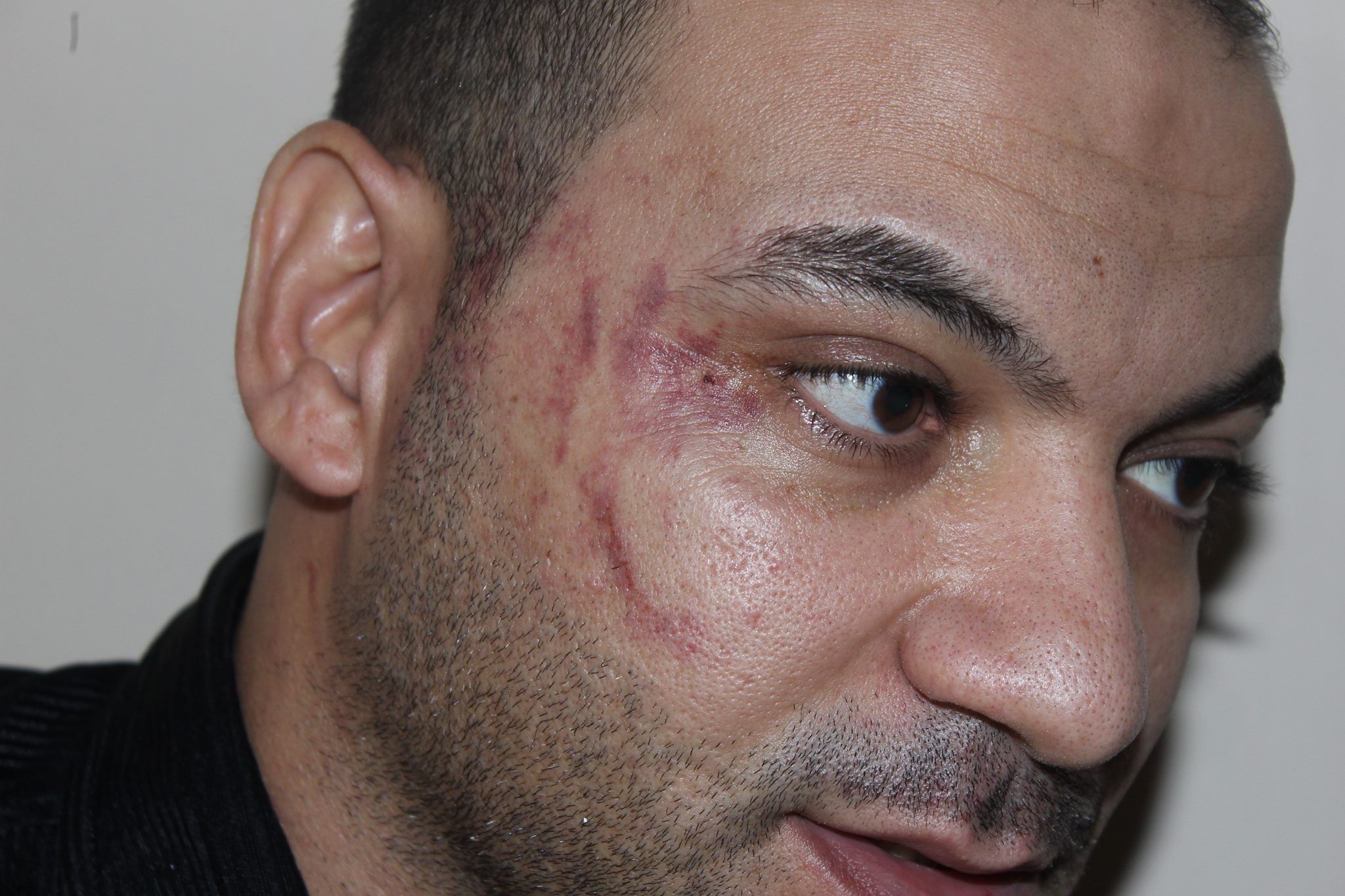 حقوق الإنسان الأردني: الاعتداء على العامل المصري لا يجيزه القانون